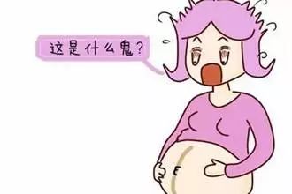 怀孕没黑线的基本是女宝宝了(妊娠线和生男生女有关吗)