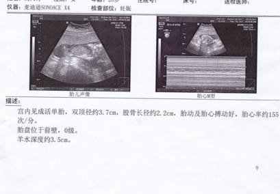 17周男孩和女孩b超的区别(男孩女孩b超有哪些区别图)