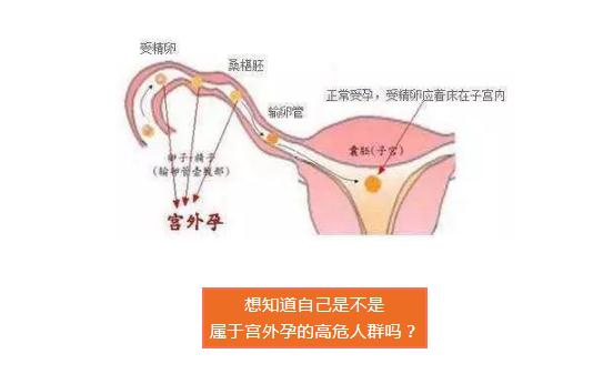 血液hcg偏高有几种可能(HCG阴性是否怀孕)