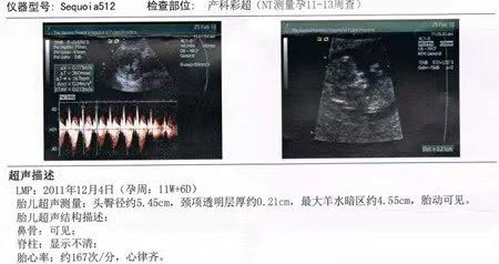 Nt值看男女85%的准确率是真的吗(具体分辨方法有哪些)