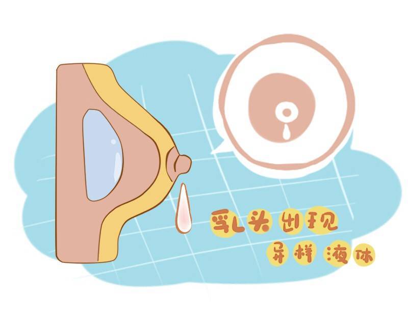 哺乳期乳腺炎为何会如此棘手(症状有哪些)