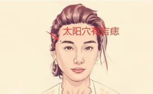 女人脸上十大吉痣(眼尾有痣预示财运很旺)