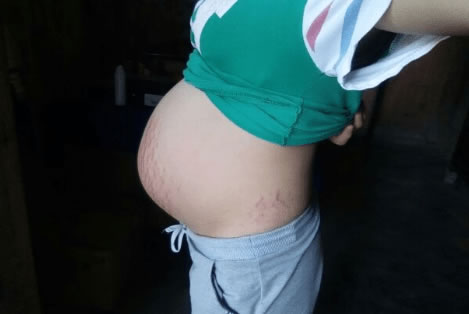 怀孕女孩的最准确症状有孕1-3个月(22个孕1-3月怀女孩症状)
