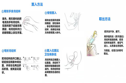 月经杯怎么用的(清洗与保存) 图解