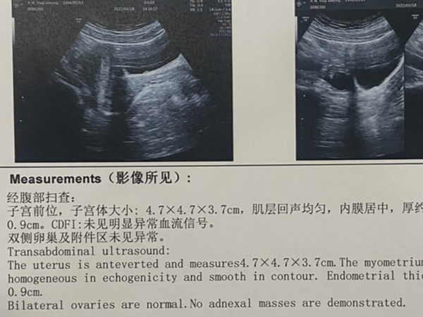 内膜0.9移植成功几率多大？