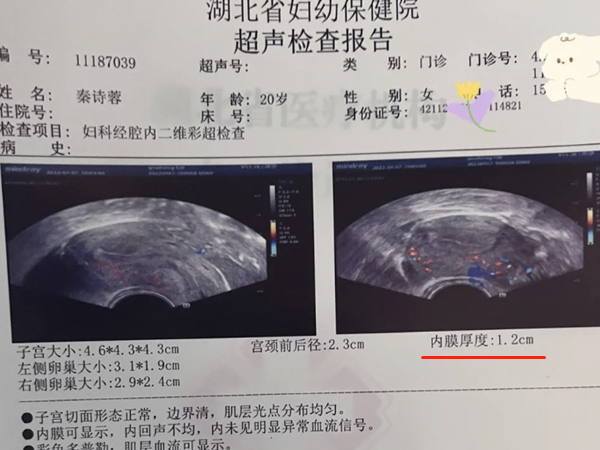 内膜1.2移植是不是太厚了？