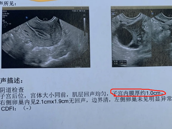 内膜1.0不来月经的原因？