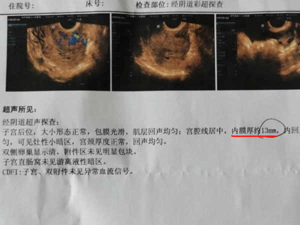 内膜13mm移植冻胚有成功几率？