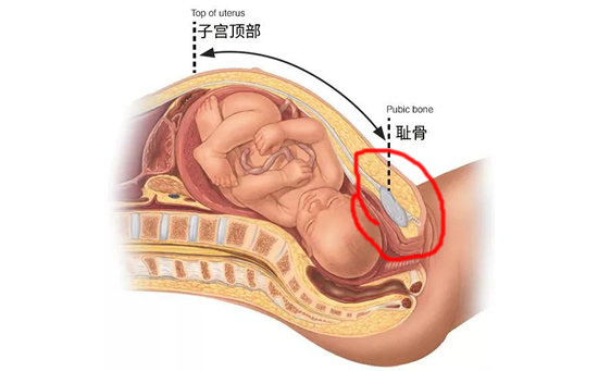 孕妇耻骨位置(孕妇耻骨疼什么原因)