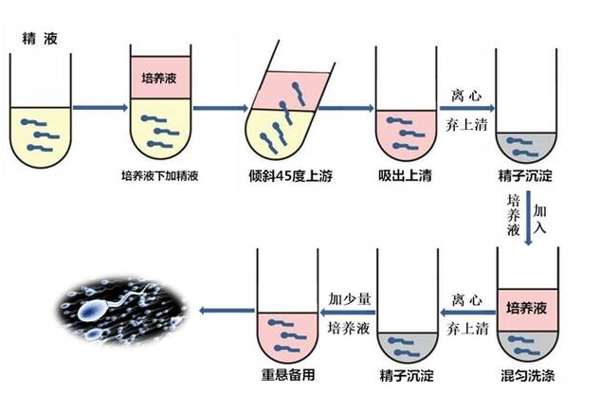 什么是XY精子分离术 第三代试管和XY精子分离术的区别