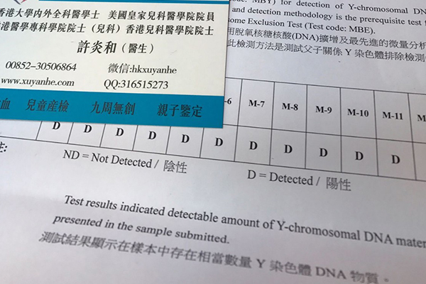 血液dna检测男孩女孩的方法 验血测男女准确率