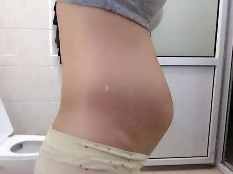 怀女宝腰长肉肚型图片(生男女孩的肚型是什么样)