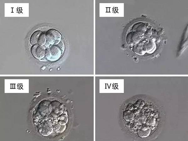 试管婴儿受精卵级别区分方法分享,分为几级你一定要看看