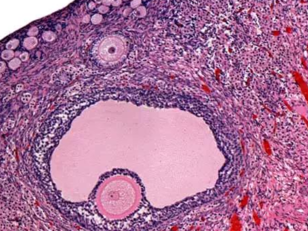 空卵泡和正常卵泡区别 是否一样？