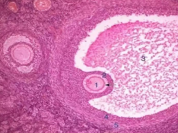 空卵泡会不会长大 能否排卵？
