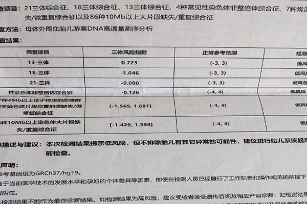 t21t18t13哪个高是男孩 无创三体指数看男女的方法