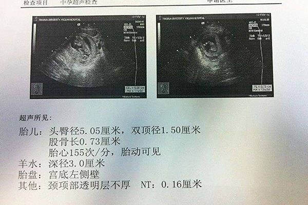 10秒测出怀男孩和女孩的方法(怀孕自测男女简单方法)