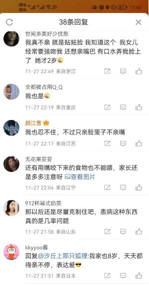 少女连续数日高烧不退确诊接吻病 eb病毒是怎么感染的