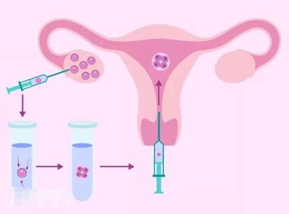 人工授精如何提高着床率(附3大方面事项)