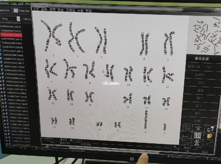 女性备孕前检查项目及费用(男士孕前检查项目及费用)