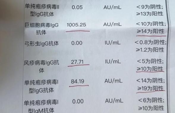 TORCH10项是什么检查(如何读懂torch十项检查结果对照表和结果怎么看)