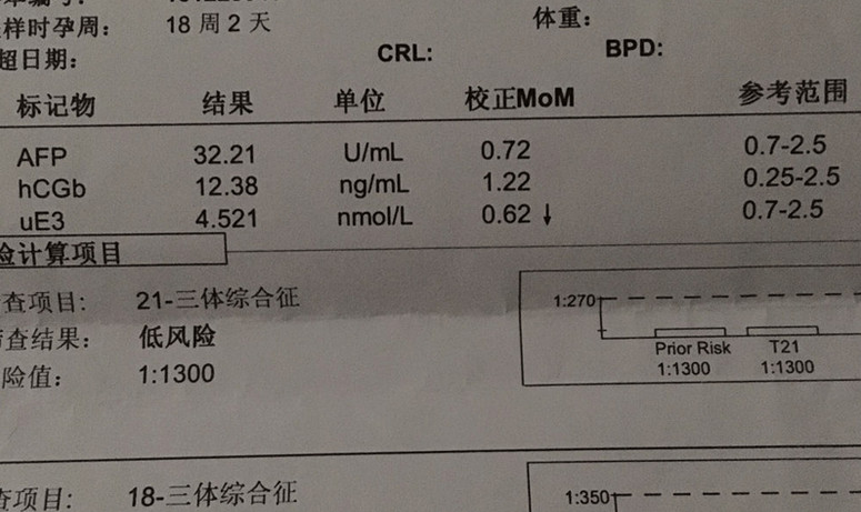 唐氏筛查HCG看男女公式是什么(民间判断胎儿性别的方法)