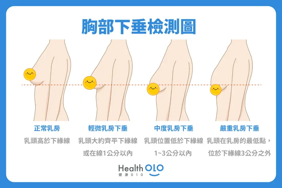 乳房类型有哪些(怎么确定自己胸下垂了)