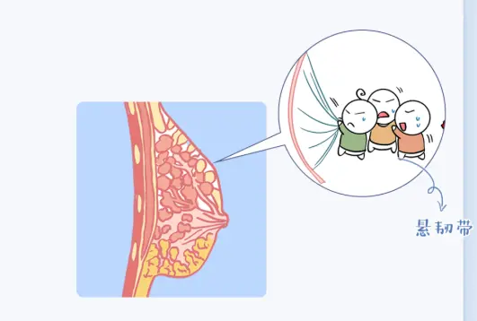 乳房类型有哪些(怎么确定自己胸下垂了)