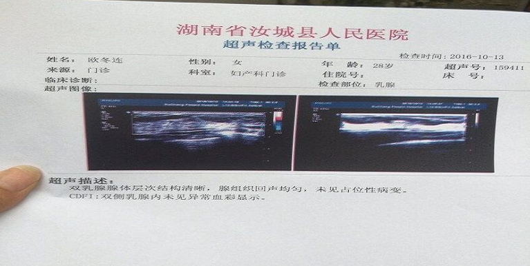 如何解读乳腺报告单(乳腺分级标准)