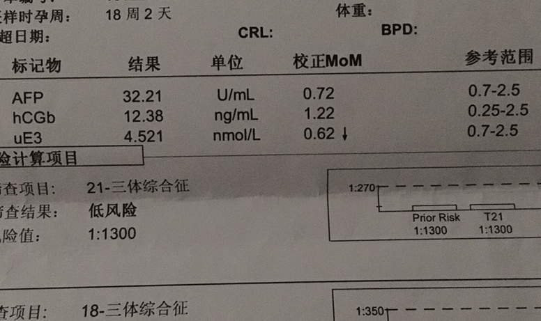 从唐筛的结果怎样判断宝宝性别(唐筛看男女准确率高吗)