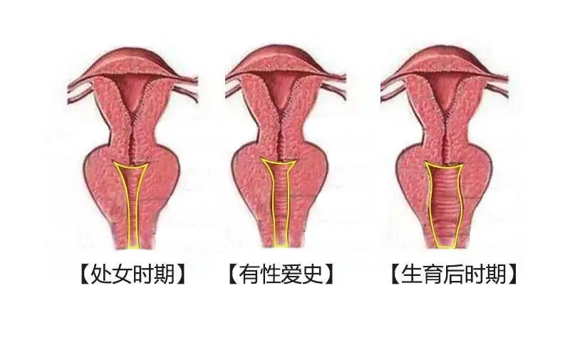 啪啪多了阴道会松弛吗？